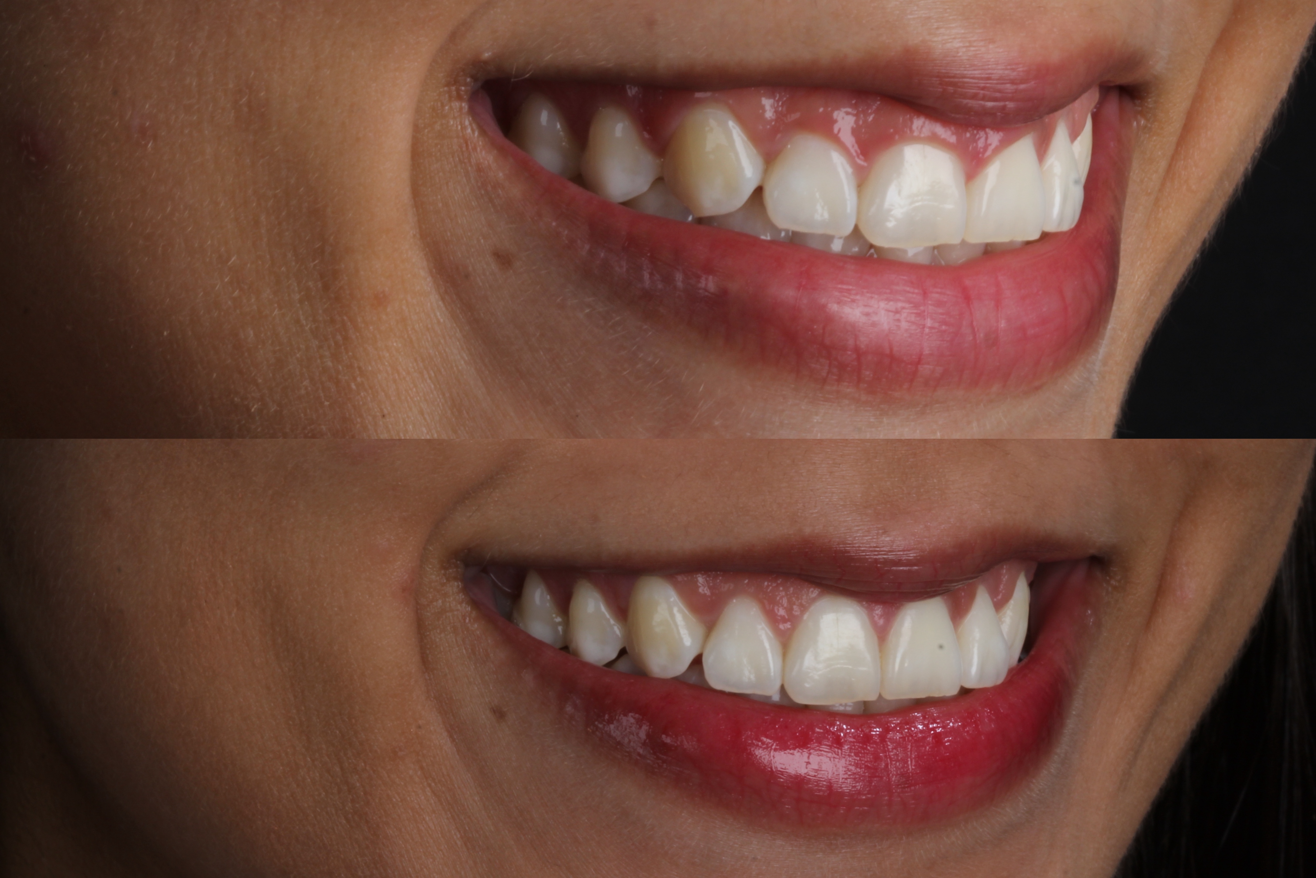 Cirurgia periodontal